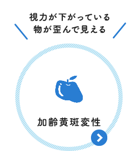 視力が下がっている 物が歪んで見える：加齢黄斑変性