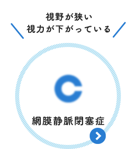 視野が狭い 視力が下がっている：網膜静脈閉鎖症