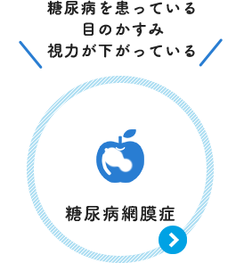 糖尿病を患っている 目のかすみ 視力が下がっている：糖尿病網膜症