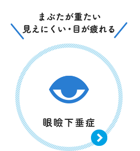 まぶたが重たい 見えにくい・目が疲れる：眼瞼下垂症