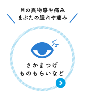 目の異物感や痛み まぶたの腫れや痛み：さかまつげ・ものもらい