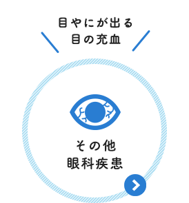 目やにが出る 目の充血：その他眼科疾患