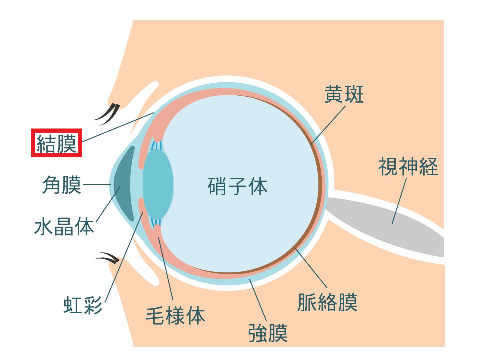 結膜弛緩症の原因