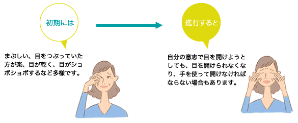 眼瞼痙攣とは？