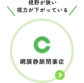 視野が狭い 視力が下がっている：網膜静脈閉鎖症