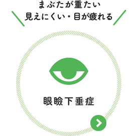 まぶたが重たい 見えにくい・目が疲れる：眼瞼下垂症