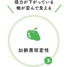 視力が下がっている 物が歪んで見える：加齢黄斑変性